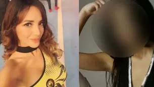 Rosángela Espinoza revelas fotos de su pasado tras controversia por cirugías