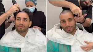 Said Palao se rapó por completo para someterse a trasplante capilar en Madrid / Instagram