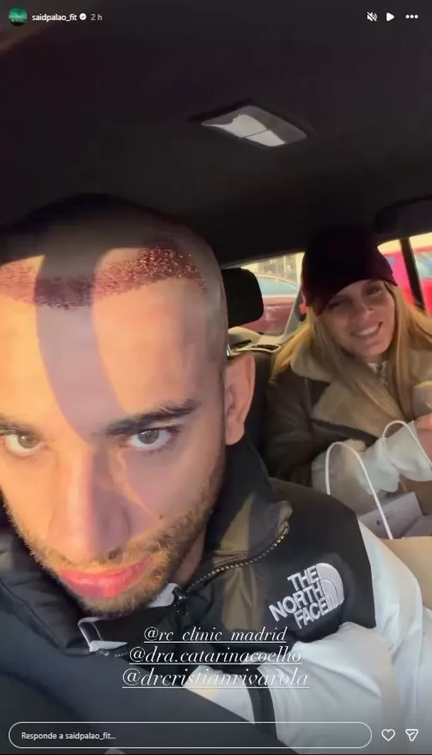 Said Palao mostró cómo quedó tras someterse a trasplante capilar en Madrid / Instagram