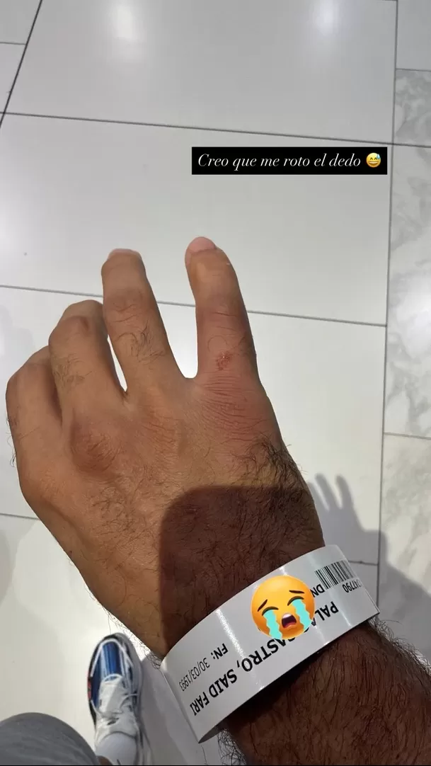 Said Palao mostró cómo quedó su dedo tras fuerte semifinal en EEG / Instagram Said Palao mostró cómo quedó su dedo tras fuerte semifinal en EEG / Instagram