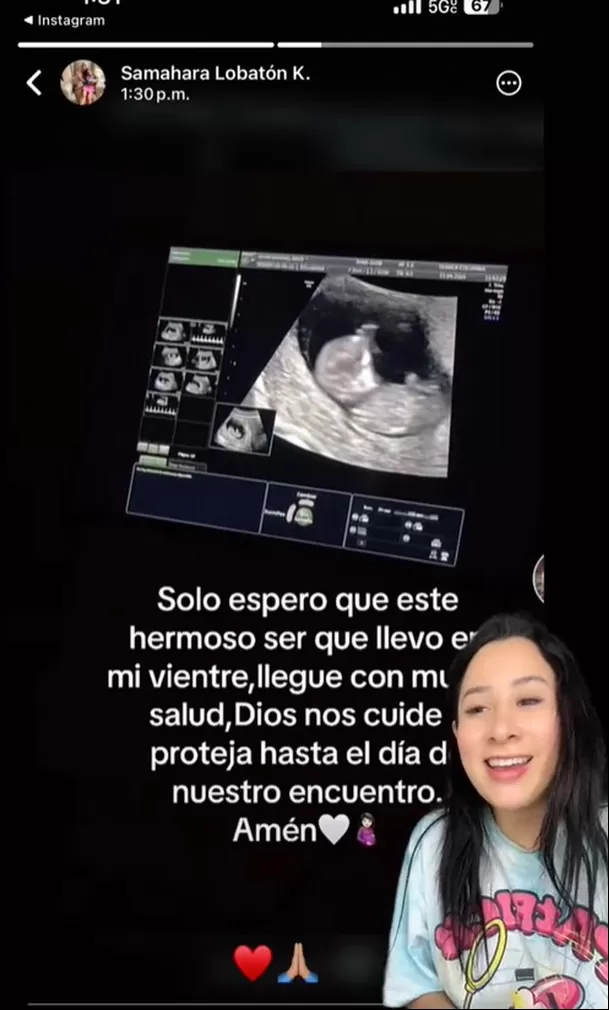 Usuario de Tiktok publicó la ecografía de Samahara Lobatón | Imagen: TikTok