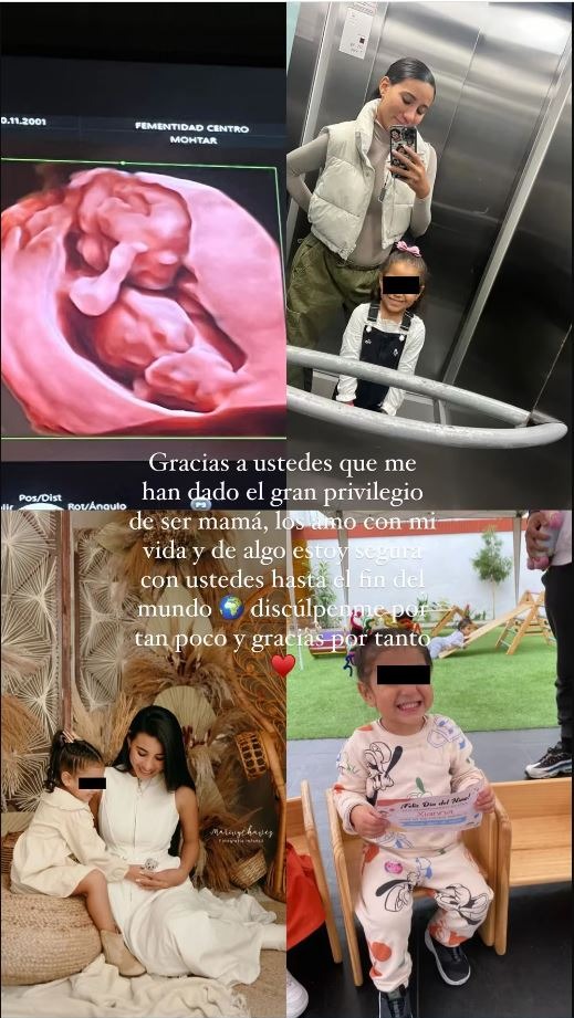Samahara Lobatón compartió la imagen de la ecografía de su segundo bebé/Foto: Instagram