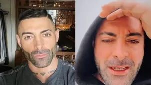 Sebastián Lizárzaburu reapareció tras lucir herida en rostro y preocupar a fanáticos / Instagram