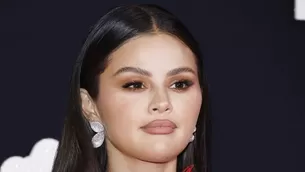 Selena Gomez confirm+p procedimiento cosmético mientras defendía nuevo romance. Fuente: Instagram