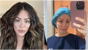 Sheyla Rojas se arrepiente de hacerse ‘retoque’ en el rostro / Instagram/TikTok