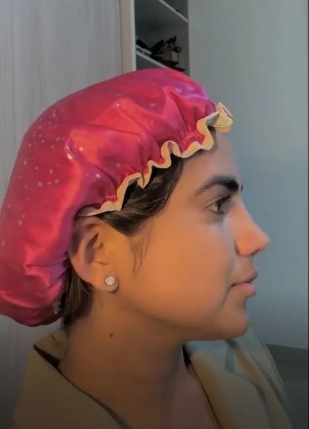 Susana Alvarado muestra cómo quedó su nariz tras cirugía / Captura / TikTok Susana Alvarado muestra cómo quedó su nariz tras cirugía / Captura / TikTok