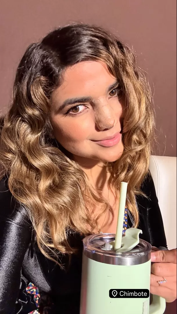 Susana Alvarado y su operación nasal / Instagram Susana Alvarado y su operación nasal / Instagram