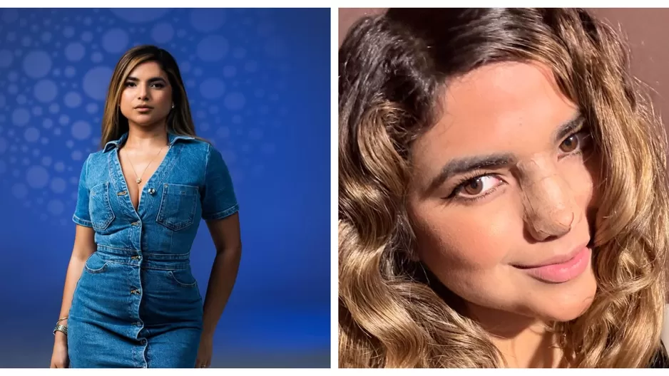 Susana Alvarado muestra su rostro tras operación nasal por motivos de salud/ Instagram Susana Alvarado muestra su rostro tras operación nasal por motivos de salud/ Instagram