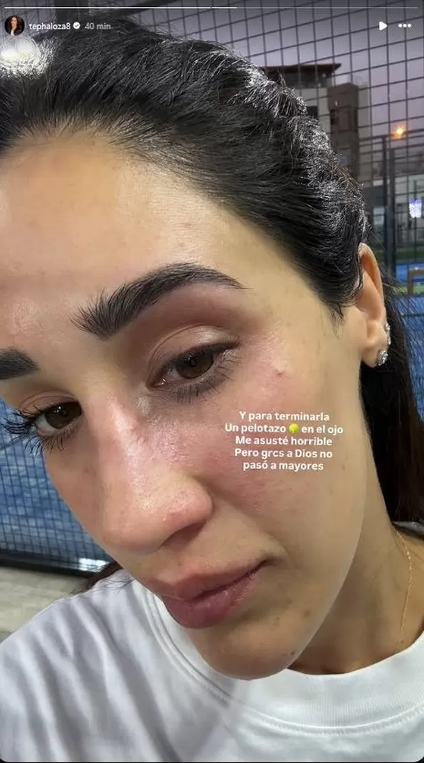 Tepha Loza termina con el rostro golpeado tras aparatoso accidente deportivo / IG: tephaloza8