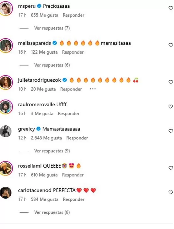 Tini Stoessel recibió elogios de sus seguidores tras cirugía estética / Instagram 