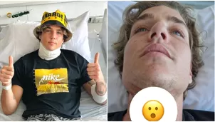 Tomi Narbondo impactó al mostrar terrible cicatriz de su operación en el cuello / Instagram