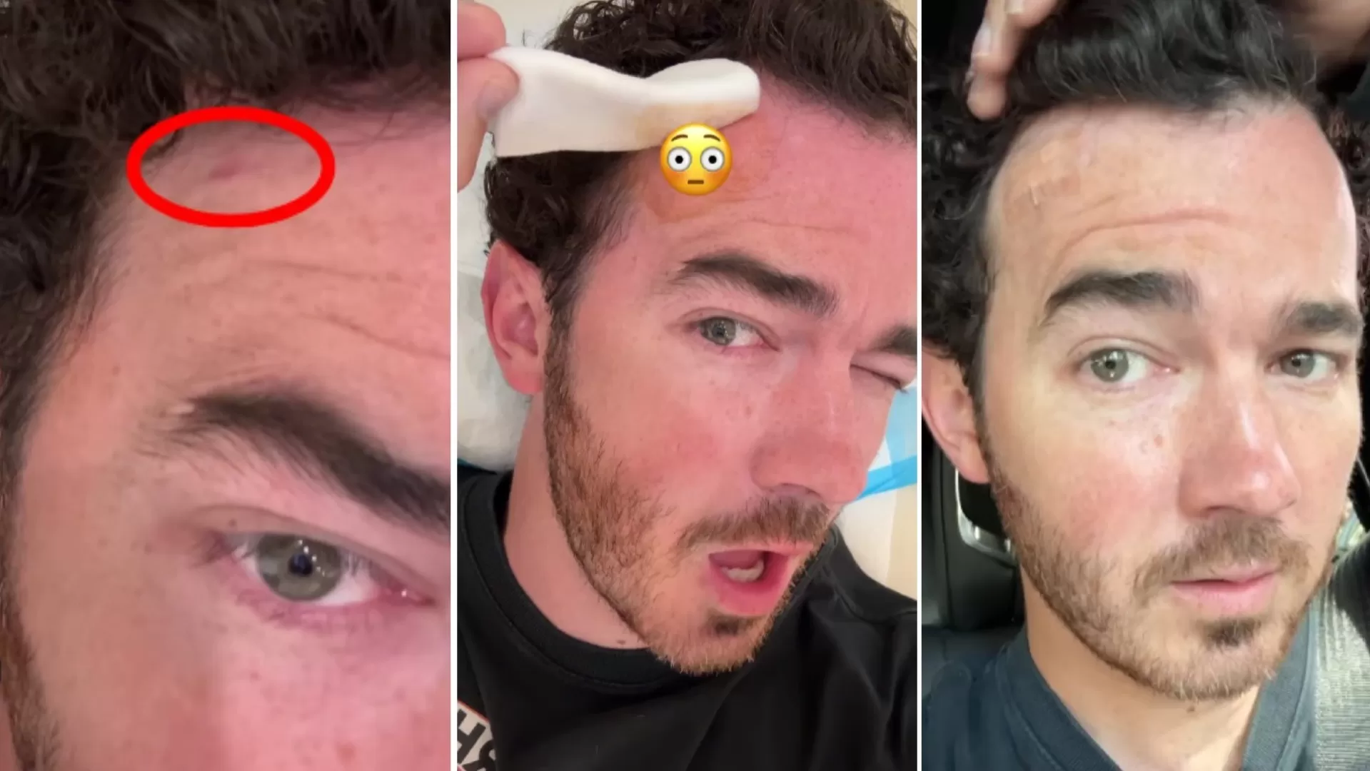 Kevin Jonas se sometió a una operación de cáncer de piel/Foto: TMZ