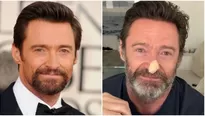 "Usen protector solar, por favor": Hugh Jackman se realizó biopsias ante riesgo de cáncer de piel