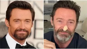 "Usen protector solar, por favor": Hugh Jackman se realizó biopsias ante riesgo de cáncer de piel