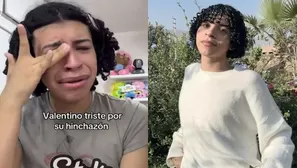 ¿Qué le pasó a Valentino Palacios? / Instagram