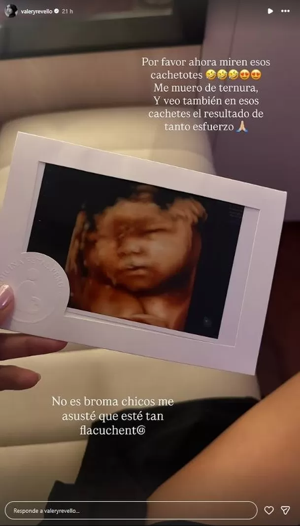 Valery Revello emocionada con nueva ecografía de su bebé / IG: valeryrevello