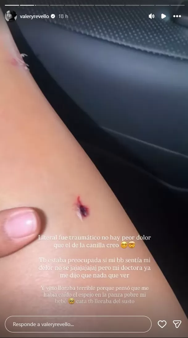A pocas semanas de dar a luz, Valery Revello vivió un dramático accidente al intentar proteger a su hija. Video: IG @valeryrevello A pocas semanas de dar a luz, Valery Revello vivió un dramático accidente al intentar proteger a su hija. Video: IG @valeryrevello
