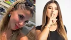 Yahaira Plasencia apareció con herida en los labios ¿Qué le pasó?