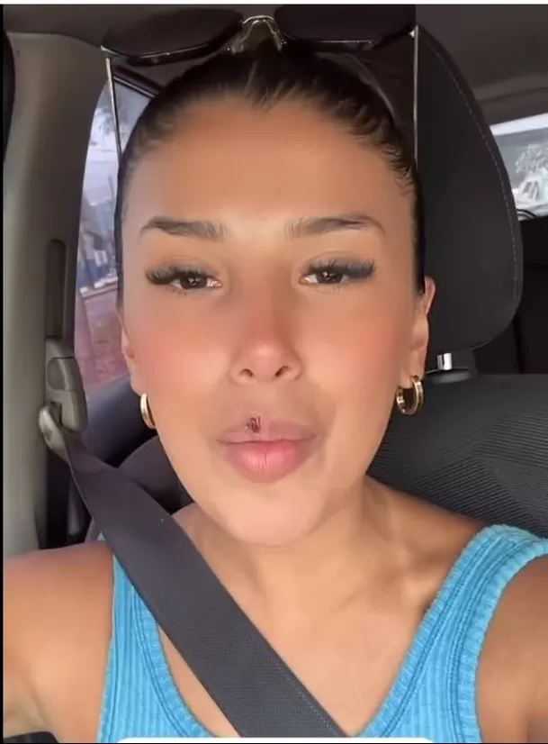 La cantante Yahaira Plasencia, narró cómo la herida de su labio superior se agravó y cómo se siente por estos días/Foto: Instagram