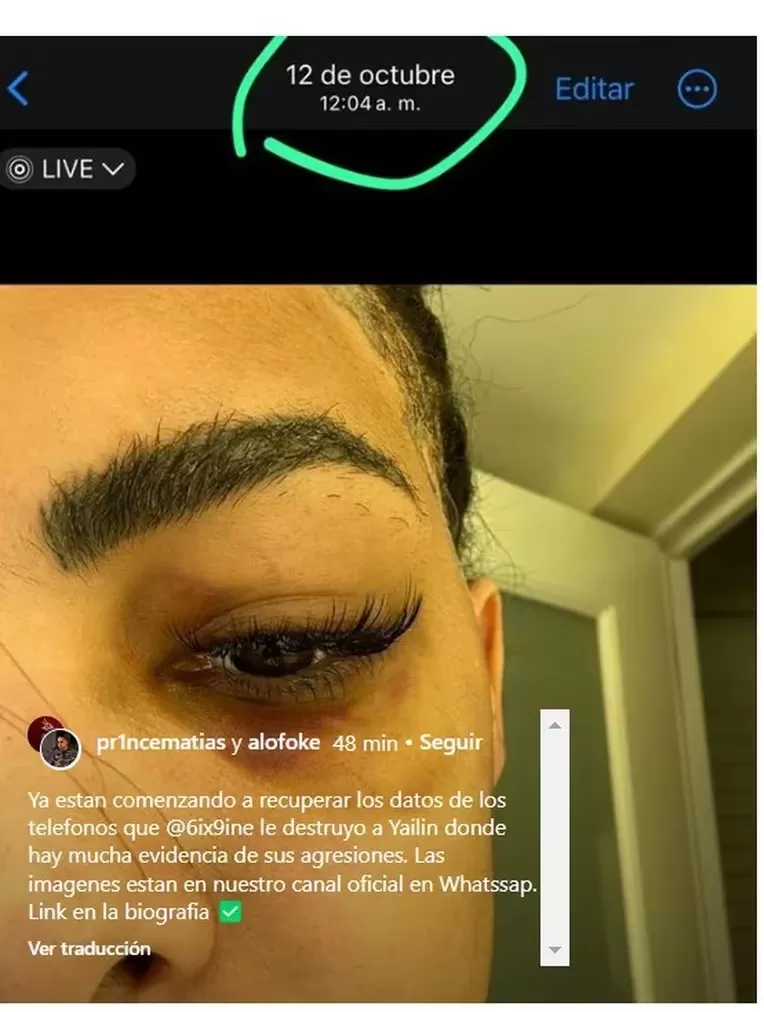 El locutor Alofoke publicó una fotografía en la que aparece Yailin golpeada. Fuente: Instagram