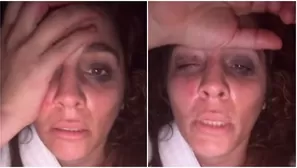 Yiddá Eslava sufrió terrible accidente durante rodaje de su película. Fuente: Instagram