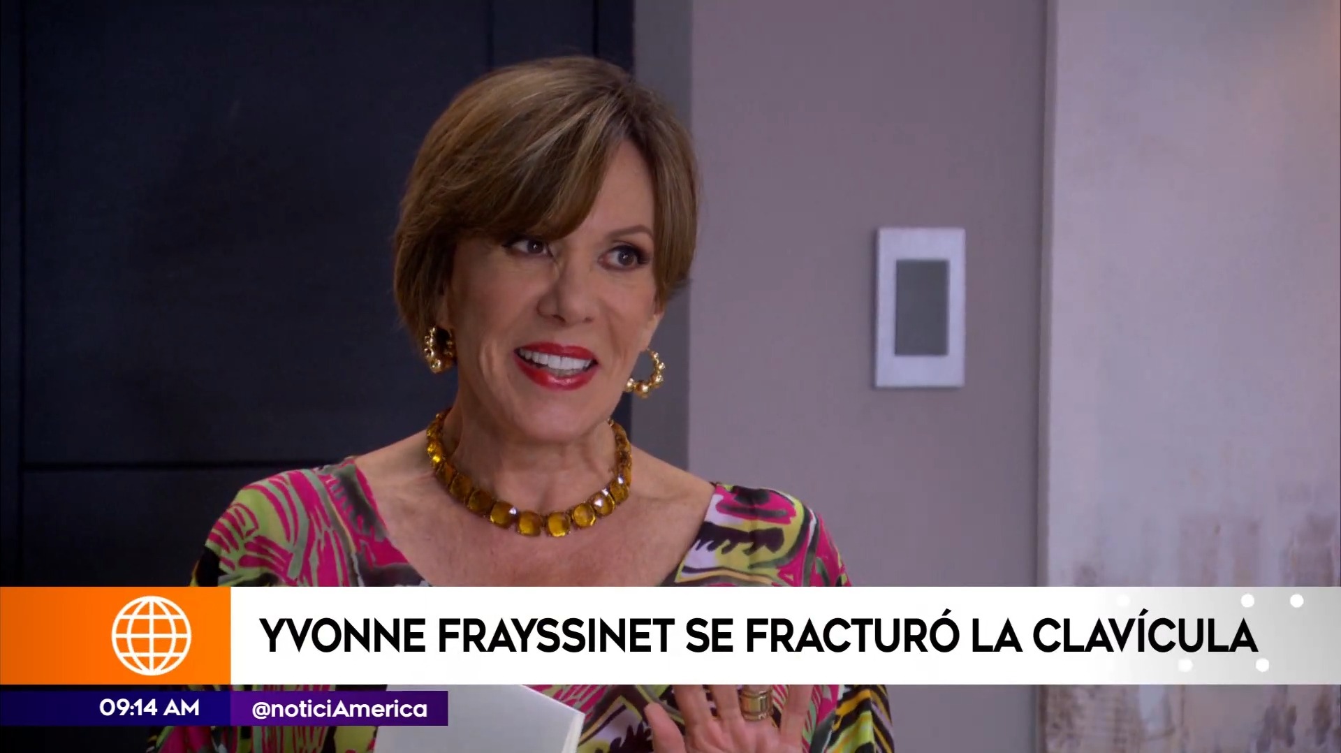 Yvonne Frayssinet sufrió accidente en su casa / América Espectáculos 