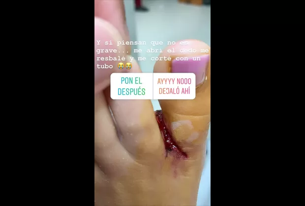 Flavia Laos sufrió accidente en Punta Cana previo al Año Nuevo