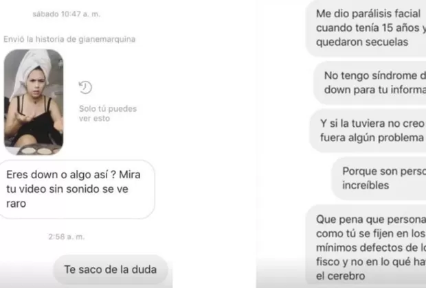 Gianella Marquina recibió desatinada pregunta sobre su parálisis facial y dijo esto