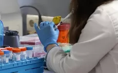 Argentina registró primera muerte por viruela del mono - Noticias de nutricion