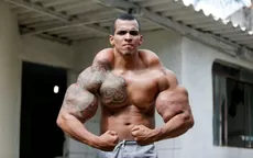 Fisicoculturista brasilero quería ser Hulk y casi pierde los brazos - Noticias de fisicoculturista