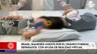 Brasil: siameses unidos por el cráneo fueron separados con ayuda de realidad virtual