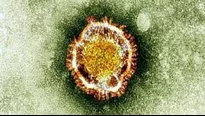 Coronavirus: Estudio identifica cinco genes asociados a formas graves de COVID-19. Foto: AFP