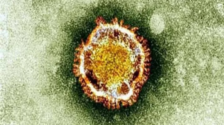 Coronavirus: Estudio identifica cinco genes asociados a formas graves de COVID-19. Foto: AFP Coronavirus: Estudio identifica cinco genes asociados a formas graves de COVID-19. Foto: AFP