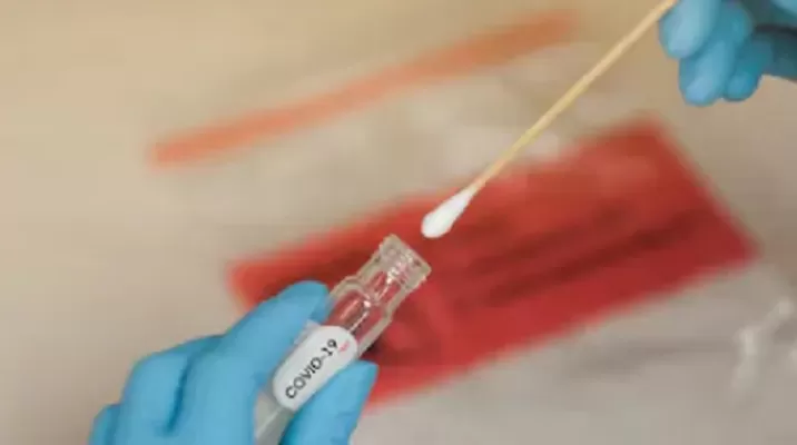 Estados Unidos aprueba que laboratorio comercialice test rápido del coronavirus en su territorio. Foto: Shutterstock Estados Unidos aprueba que laboratorio comercialice test rápido del coronavirus en su territorio. Foto: Shutterstock