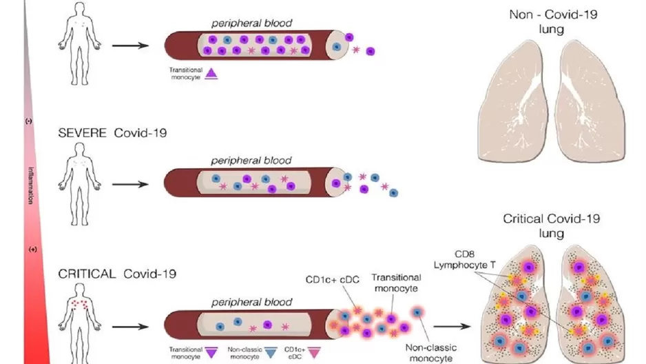 COVID-19 afecta a distintas células del sistema inmunitario según la gravedad. Foto: EFE