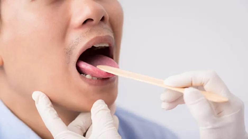 COVID-19: Lesiones en la lengua y manchas en pies y manos podrían ser síntomas del coronavirus, según un estudio. Foto: iStock referencial