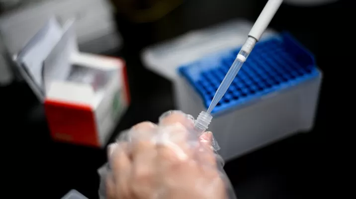 EE.UU. confirmó un caso de viruela del mono y cuatro sospechosos. Fuente: Getty images EE.UU. confirmó un caso de viruela del mono y cuatro sospechosos. Fuente: Getty images