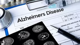 Estados Unidos aprueba el primer medicamento nuevo para el alzhéimer en casi 20 años. Imagen referencial: iStock