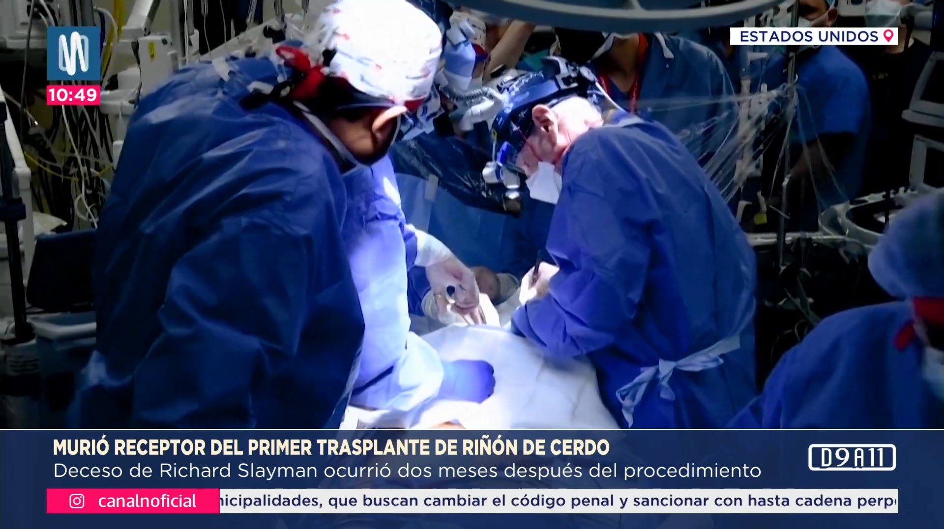 Murió receptor del primer trasplante de riñón de cerdo