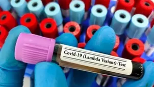 OMS dice que no existen razones para clasificar variante lambda del COVID-19 como preocupante. Imagen referencial: RC