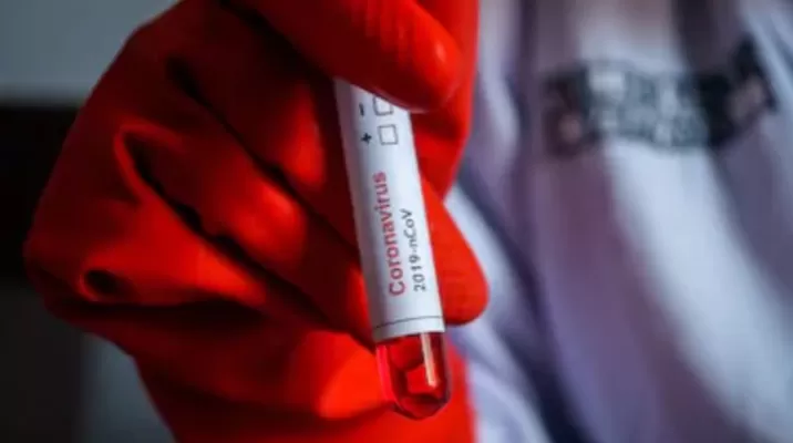 Países Bajos: Autoridades sanitarias confirman primer caso de coronavirus. Foto: Shutterstock Países Bajos: Autoridades sanitarias confirman primer caso de coronavirus. Foto: Shutterstock