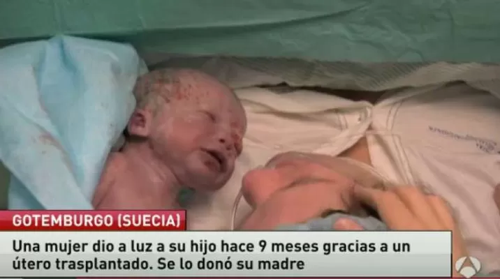 Mujer da a luz tras recibir trasplante de útero en Suecia Mujer da a luz tras recibir trasplante de útero en Suecia