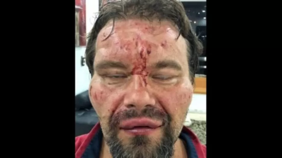 El Sindicato de Trabajadores de la Prensa de Venezuela (SNTP) denunció este viernes que el cuerpo de seguridad estatal Fuerzas de Acciones Especiales (FAES) detuvo y golpeó al periodista polaco Tomasz Surdel. Foto: SNTP El Sindicato de Trabajadores de la Prensa de Venezuela (SNTP) denunció este viernes que el cuerpo de seguridad estatal Fuerzas de Acciones Especiales (FAES) detuvo y golpeó al periodista polaco Tomasz Surdel. Foto: SNTP