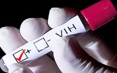 VIH: científicos logran eliminar virus en 6 pacientes con trasplantes de células madre - Noticias de sida