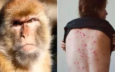 Viruela del mono: Se registra primer caso en Suecia - Noticias de protocolos