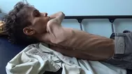 Guerra en Yemen: 85.000 niños han muerto de hambre en los últimos 4 años