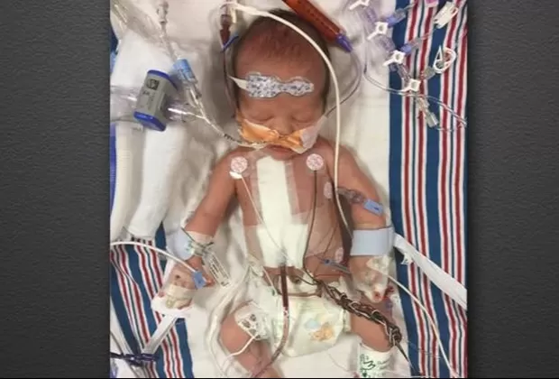 Jimmy Kimmel se conmovió al hablar del estado de salud de su hijo recién nacido