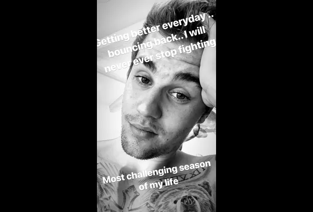 Justin Bieber depresión