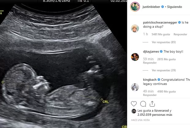 Hailey Baldwin embarazo