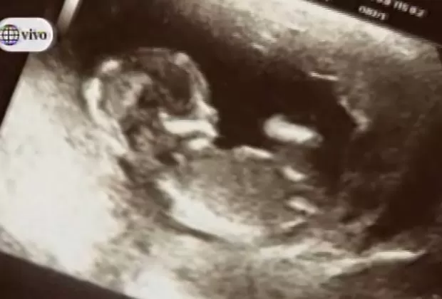 Melissa Paredes confirmó su embarazo 